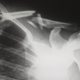 are you equipped to handle an IOD (injured on duty)?